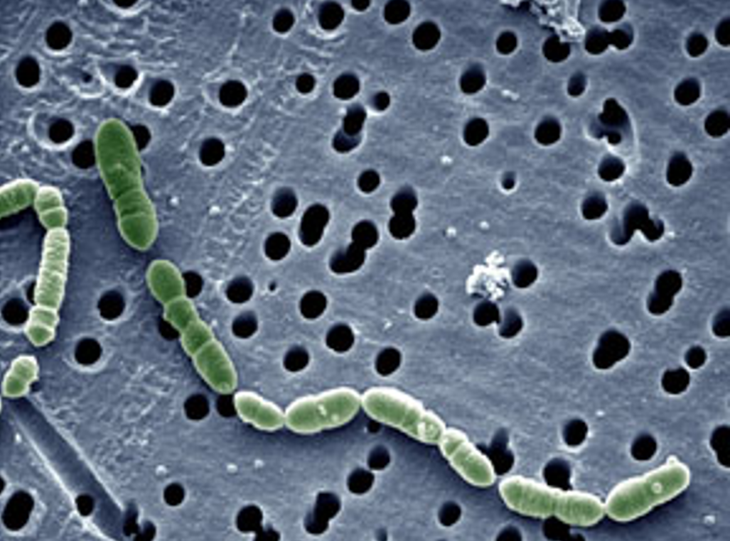 Oenococcus oenin